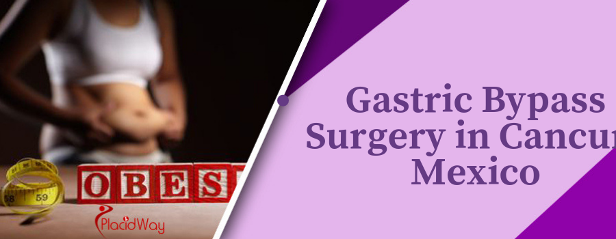 Gastric Bypass Surgery in Cancun, Mexico